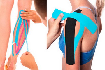 Кинезиотейпирование | Лечение боли и отёков тейпами